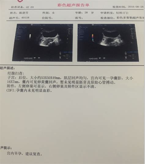 温度会影响鸡的性别吗