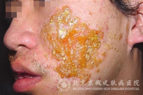 生孩子的痛苦是什么样的