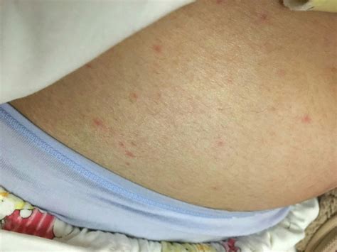 孕14周下午肚子有点痛