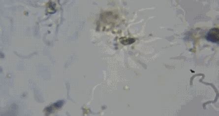 消毒柜能杀灭幽门螺杆菌吗
