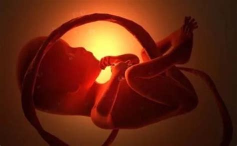 胎儿脐带绕颈是什么原因导致的?