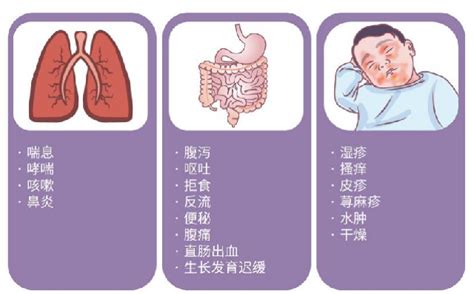 婴儿牛奶过敏有哪些症状