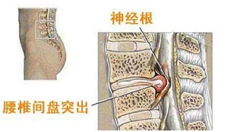 铁腰板效果怎样?