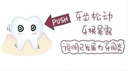 門牙有松動怎么辦