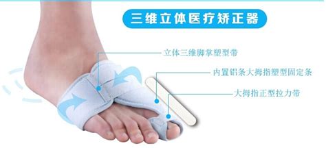 我穿人字拖穿的腳丫有點(diǎn)腳拇指外翻怎么辦