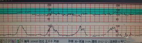 胎心一直130左右正常吗