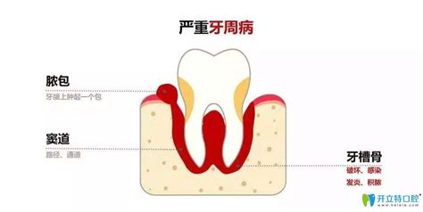 小孩长牙齿不舒服怎么办