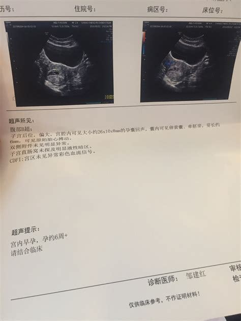 45天胎囊大小