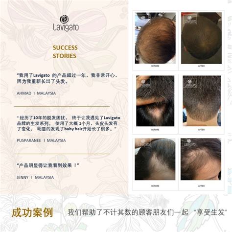 产后多久可以洗头发