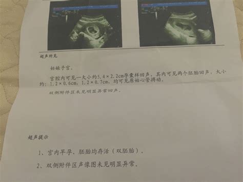怀孕40天hcg不翻倍了