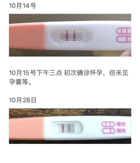 孕8周胸不胀痛正常吗