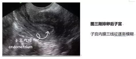 子宫厚度4.8正常吗