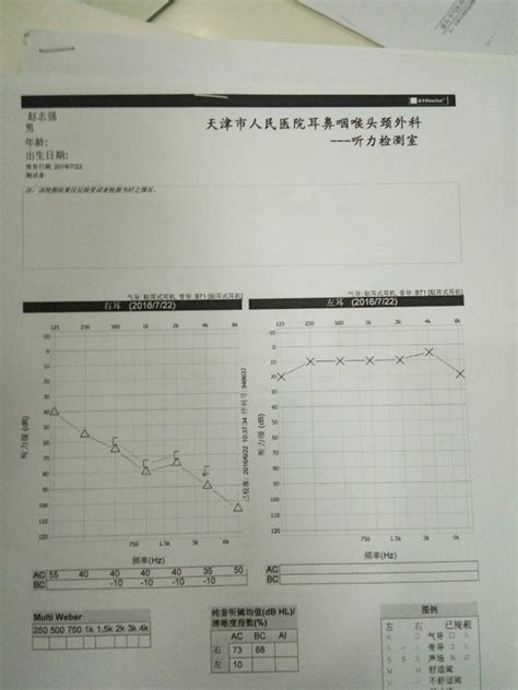 宝宝耳聋无法医治，竟是孕期胎教不当害的