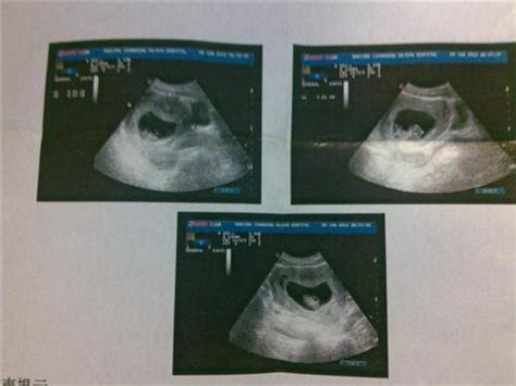 胎宝宝在妈妈肚子里的3月、7月、10月，应该怎么吃