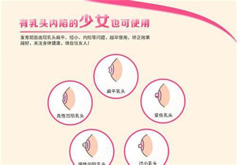 乳房偶尔刺痛就像针扎咋回事