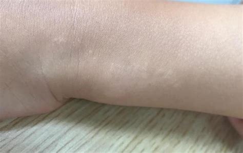 宝宝脸特别白身上不白怎么回事