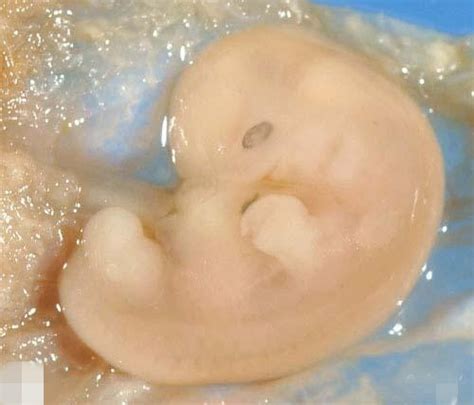 十二周的胎儿真实图