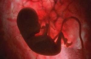 孕24周胎儿是什么样子
