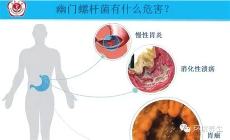 如何预防宝宝消化不良