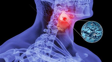 畏寒喉咙痛喉咙干