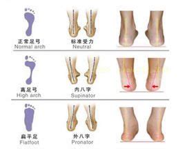 1-2岁小孩脚内八字图片