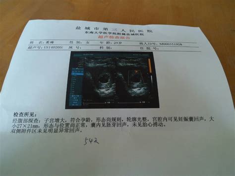 西安怀孕一个月b超照片