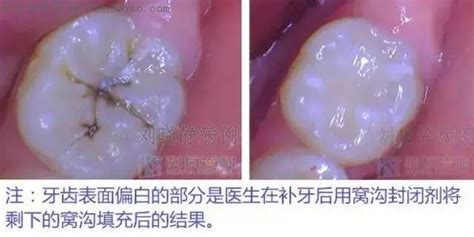 3.＂皮牙子＂是: 什么意思