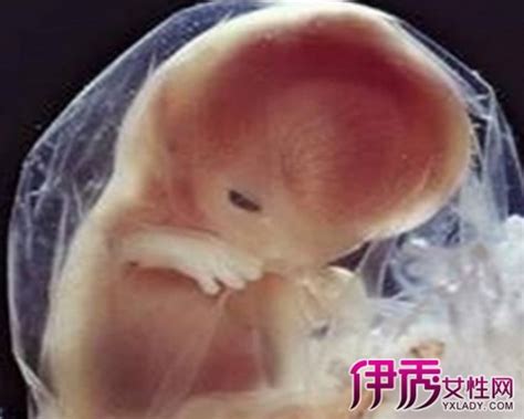孕32周真实胎儿图片