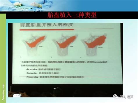 瘢痕子宫0.12cm有事吗