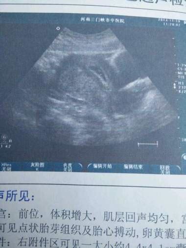 孕9月胎儿发育情况