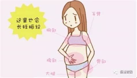 怀孕期间孕妈肚子大的原因有哪些