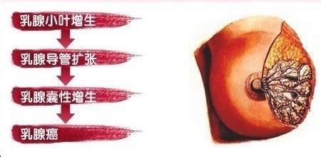 正常乳房直径是多少
