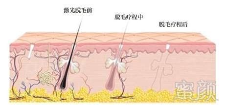 毛发多容易滋生细菌吗