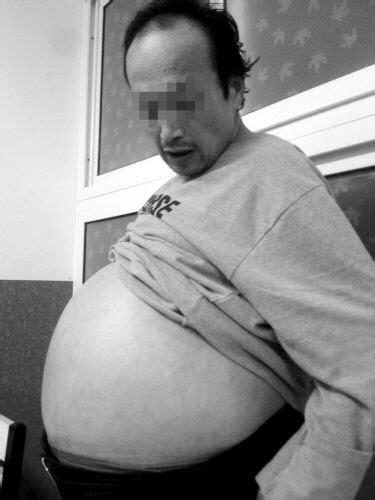 男人吃撑后肚子肥得像游泳圈