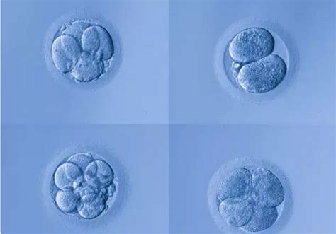 试管婴儿移植鲜胚和囊胚有什么区别
