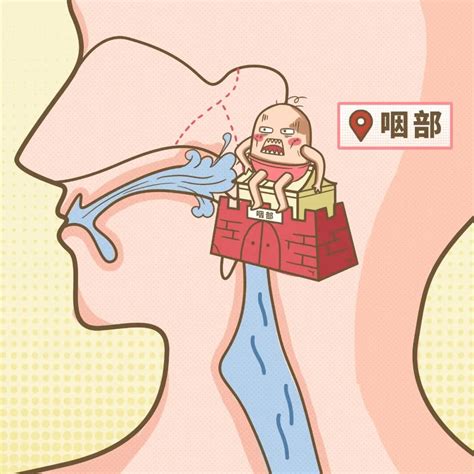 慢性咽喉炎的根治方法