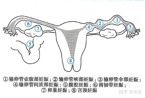 孕妇宫颈管测量怎么做的