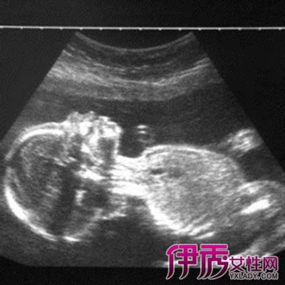 怀孕14周胎儿的位置图