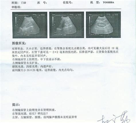 腹部b超是不是要喝水