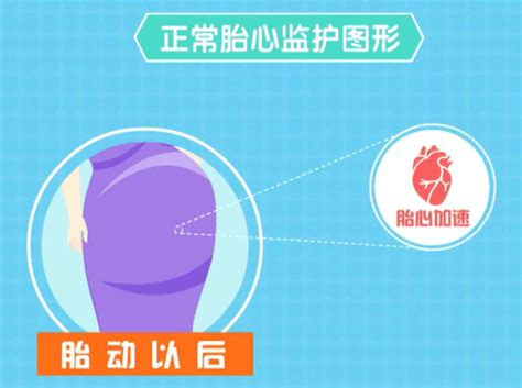 胎心监护曲线在160左右