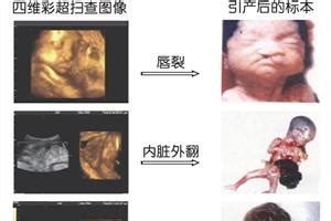 6周左右的胎儿图
