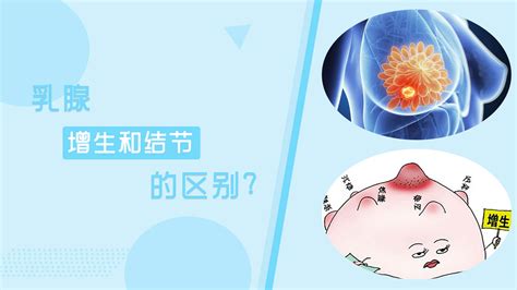 乳房结节多大需要手术