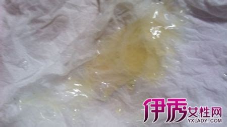 hcg158正常吗