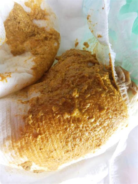 奶粉喂养宝宝的大便颜色