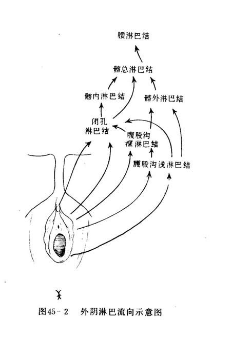 外阴癌的早期症状