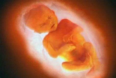 孕6周的胎儿的真实图