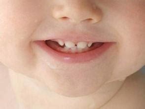 婴幼儿的乳牙要长得好,营养和阳光不可缺少