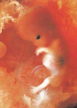 怀孕三个月半的胎儿图片