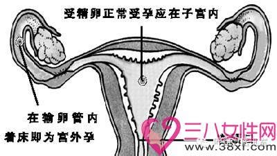 停经后hcg380