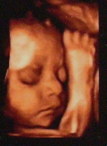 怀孕38周胎儿的发育情况